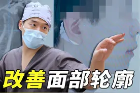 人中变长、上前牙舌倾？正畸如何精准调整改善面部轮廓！ #正畸视频封面