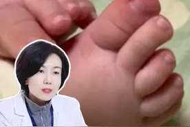 几个月的宝宝也会得甲沟炎?只要指甲剪错就很容易得！ 医生30秒教你处理~
#甲沟炎 #修脚 #嵌甲 #冷知识 #抖出健康知识宝藏
