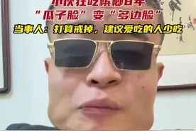小伙狂吃槟榔8年，“瓜子脸”变“多边脸”，当事人：打算戒掉，建议爱吃的人少吃#槟榔 #脸型 #饮食 #男性视频封面