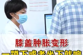 膝盖肿胀变形，一蹲下或者坐下就响，这是膝盖出现了退变 #膝盖疼 #骨科 #硬核健康科普行动  #涨知识 #医者仁心视频封面