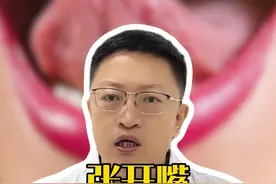 张开嘴，中医教你看舌底 #医疗健康创作训练营 #硬核健康科普行动 #舌诊 #中医 #养生视频封面