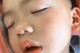 #腺样体肥大 #腺样体面容 #耳鼻喉臧洪瑞视频封面