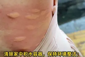 广州疾控提醒：全市11区均涉蚊媒传染病病例 请注意防蚊灭蚊 #广州11区均涉及蚊媒传染病病例  #社会 #抖音热评