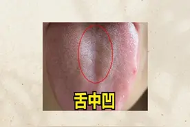 舌头哪里凹，哪里就虚，教你看舌象，补五脏之虚！ #中医养生视频封面