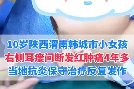 这位患者耳前瘘管间断感染4年，来武汉寻求我的治疗 #耳前瘘管 #抖出健康知识宝藏   #用健康的方式做不健康的事  #武汉陈金辉视频封面