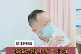 宝宝屁股上有个小沟，孕期叶酸服用不够导致的#叶酸 #隐性脊柱裂 #育儿 #我的门诊故事 #硬核健康科普行动视频封面