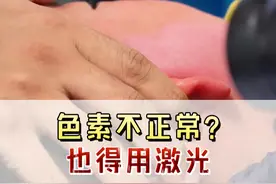 色素不正常？也得用激光 #瘢痕 #疤痕 #瘢痕修复 #疤痕修复 #瘢痕修复专家王珏视频封面