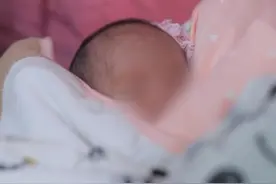 看着心疼人啊，20天的新生儿脑积水需要赶紧手术。#先行性脑积水 #新生儿 #我的门诊故事 #医学科普视频封面