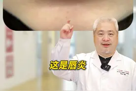 嘴唇总是干燥起皮，它可不是单纯的喝水喝少了！ 当心是#唇炎#剥脱性唇炎  #医学科普 #硬核健康科普行动  #嘴唇干裂视频封面