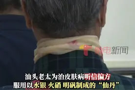 汕头八旬老太为治皮肤病听信偏方，服用以水银、火硝、明矾制成的“仙丹”，后出现头晕呕吐等症状。经检查，其尿液中汞含量超正常值近2万倍。因救治及时，患者已顺利转出ICU。视频封面