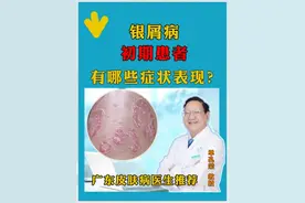 银屑病初期有哪些症状表现？ #广东银屑病医生推荐 #单孔荣医生 #广东银屑病 #挂单孔荣号 #硬核健康科普行动视频封面