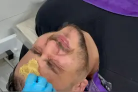 头上没毛也可以体验的柳州生姜洗头，中国人头发多的秘密就是这个吗？#柳州洗头 #生姜洗头 #中外差异 #外国人在中国 #心动打卡指南视频封面