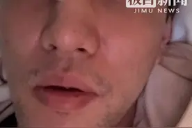 郭艾伦眼部受伤流血！本人发声：瞎了我就不活了，我以后可能打不了篮球视频封面