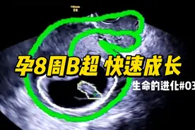 孕8周B超 快速成长 | 生命的进化03 #怀孕那些事 #孕期知识视频封面