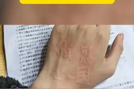 皮肤上能写字？这可不是超能力，而是荨麻疹！#人工性荨麻疹 #皮肤划痕症 #手上写字 #医学科普视频封面