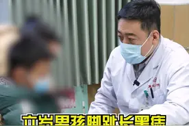 六岁男孩脚趾长黑痣，家长怀疑恶性黑色素瘤。 #肿瘤免疫博士汪治宇 #肿瘤 #黑色素瘤视频封面