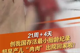3月13日，广东深圳，超早产儿“肉肉”出院回家啦！“肉肉”出生时胎龄只有21周4天，21周超早产儿被视为人类生存极限，此前国内尚无21周超早产儿存活记录。#早产儿 #人类极限#深圳dou知道  @抖音短视频视频封面