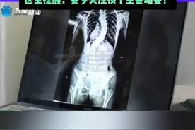 13岁女孩脊柱侧弯达60度，医生提醒：要多关注孩子坐姿站姿！#媒体精选计划视频封面