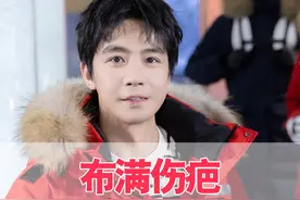 被一场爆炸戏断送花美男之路，下巴至今布满伤疤的俞灏明，生活怎么样了？#俞灏明 #王晓晨 #俞灏明烧伤毁容 #俞灏明王晓晨 #一起来看流星雨视频封面