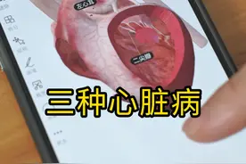 心脏是怎么运转我们的血液的？你知道我们的心脏病大致分为几种吗？#心脏病 #科普 #结构性心脏病视频封面