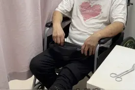 爬山用脚过度，导致小脚趾磨破，半个月坏疽流脓 这样的发展速度，我不敢让患者回家！耽误一天就可能少保一截，一天一个样子。#糖尿病足视频封面
