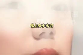 女子在商场试用口红后唇部长疱疹， 研究显示：一旦感染便无法清除，将终身携带。#万万没想到 #口红 #热门 #科普 #健康视频封面