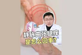 静脉曲张腿痒是怎么回事？ #静脉曲张 #静脉曲张症状 #医学科普 #抖出健康知识宝藏视频封面