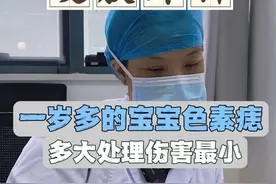 一岁多的宝宝比较大的色素痣，能处理么，多大做手术伤害最小？ #痣 #色素痣 #切痣 #医学科普 #门诊日常视频封面