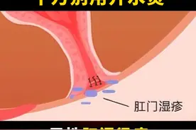 肛周很痒，反反复复。别再用开水烫了，会更严重！#肛周湿疹  可以这样处理#湿疹  #医学科普 #涨知识 #硬核健康科普行动视频封面