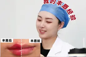 丰唇先打一半，原来是因为... 我的丰唇经验是先打单侧，打出基本轮廓，来做个对比，确认是自己满意的嘴唇，这样才能一次上岸不纠结！#八大处张倜然 #丰唇 #玻尿酸 #抖出健康知识宝藏视频封面