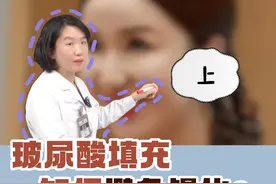 玻尿酸填充，如何避免馒化？#变美 #医美#玻尿酸填充  #都乐医生 #抖出健康知识宝藏视频封面