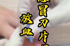 感冒刀片喉-放血#感冒 #嗓子疼 #刀片嗓 #放血疗法 #中医蔡主任视频封面
