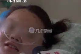 5月6日，湖南长沙，#想大口喝矿泉水女孩的双腿保住了 ，#想大口喝矿泉水的女孩喝上了橙汁 ：很感谢医护人员。         视频封面