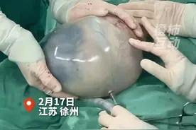 徐州一妇产医院接产“带壳宝宝”，出生自带结界，现实版哪吒？ 视频封面