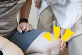 膝盖屈伸“咔咔”的弹响声到底该怎么治？#膝盖屈伸会响的看过来 视频封面