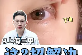 上眼皮松弛别乱选！热玛吉黄金微针水光PK #上海华东王恒 #上海王恒 #上海黄金微针 #上海热玛吉 #眼周热玛吉视频封面