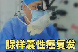 腺样囊性癌复发，再手术有哪些指征 #医学科普   #科普健康知识  #秦兴军  #腺样囊性癌视频封面