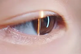 这样“才”健康：怎么遏制学生近视度数增长太快？ #学生近视视频封面