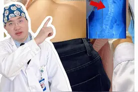母亲发现了脊柱侧弯但未在意？ #青少年脊柱侧弯 #脊柱侧弯孙新志 #脊柱侧弯保守 #郑大一附院骨科孙新志 #抖出健康知识宝藏视频封面