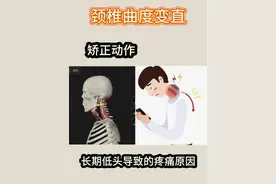 颈椎曲度变直如何矫正 颈椎曲度变直康复训练#健身 #体态纠正 #颈椎视频封面