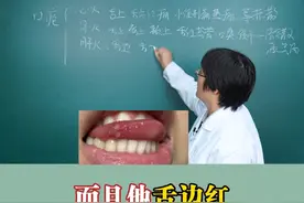#口腔溃疡 #中医 #健康 #科普 #硬核健康科普行动视频封面