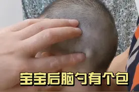 宝宝后脑勺这个包块是什么？#神经纤维瘤 #皮下囊肿视频封面