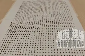 1791颗！密密麻麻！64岁大爷突然腰部剧痛，医生在其体内取出“海量”结石#肾结石 #万万没想到视频封面