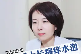 一做家务手上就容易长瘙痒水泡，别抓破，可以这样处理#科普 #汗疱疹 #家庭主妇 #痒 #糠酸莫米松乳膏