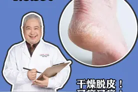 脚后跟经常起皮开裂，教你一招解决#医学科普 #皮肤 视频封面
