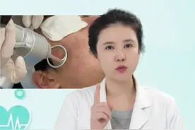 点阵激光后注意事项都有哪些？ #点阵激光 #痘坑 #激光 #皮肤美容 #硬核健康科普行动视频封面