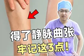 得了静脉曲张，牢记这3点！ #静脉曲张 #医学科普 #静脉曲张怎么办 #硬核健康科普行动视频封面