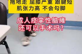 24岁男孩早产缺氧拖地走 屈膝严重 跟腱短 肌张力高 #医疗健康创作训练营  #周围神经外科医生廉民学  #硬核健康科普行动   #肌张力高  #小儿脑瘫视频封面