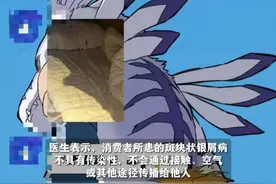 银屑病患者入住客栈后续住被拒，其隐私被员工在内部群公开并称“此人有严重皮肤病 具有传染性”，消费者称将起诉。视频封面