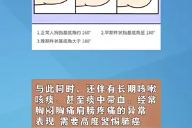 出现“杵状指”要警惕，可能是肺癌的早期信号#医学科普 #手诊图解 #手部穴位按摩 #科普一下 #小知识视频封面